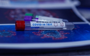 Кабмин разрешил получать результаты тестов на коронавирус через "Госуслуги"