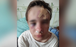 В Петербурге двое незнакомцев избили 16-летнего подростка из-за сережки в ухе