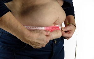 Люди с лишним весом лучше защищены от повторного заражения СОVID-19