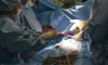 В Педиатрическом университете прооперировали младенца с рубцовым стенозом гортани 