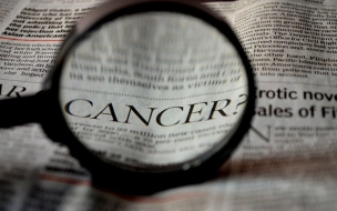 Ученые выяснили, как физические нагрузки влияют на развитие рака кишечника