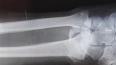 Новый рентгеновский аппарат получила поликлиника №17 на ...