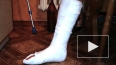 Хоккеист "Магнитки" сломал ногу, играя в футбол