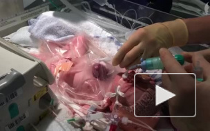 В Великобритании родилась девочка с сердцем снаружи грудной клетки