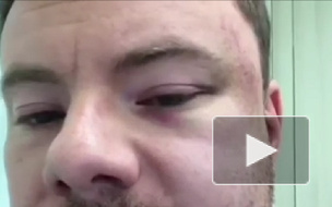 DJ Smash показал на видео свое лицо после избиения 