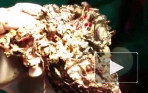 В Индии хирурги извлекли из желудка девушки 1,6 кг золотых украшений