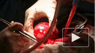 Граждан Украины будут распродавать на органы