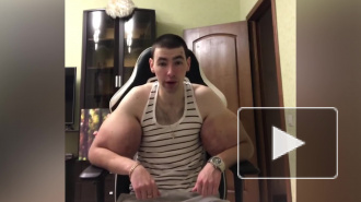 "Руки-базуки" готовится к операции по удалению синтола. У Кирилла Терешина сильное воспаление 