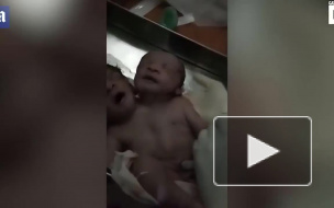 Появилось видео двухголового младенца, который родился в Индии