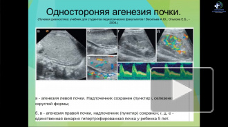 Аномалии развития почек глазами врача визуальной диагностики. Лукьянова А. А.