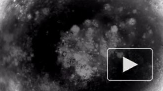 Работающую модель человеческого сердца вырастили из стволовых клеток